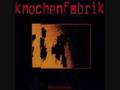 Knochenfabrik - Du bist so anders